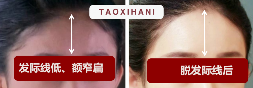 tran